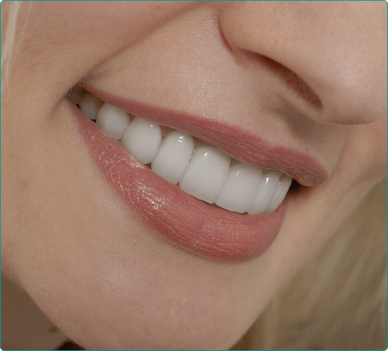 Close up of blonde woman smiling with straight white teeth