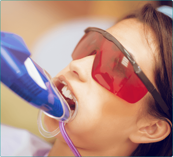 Young woman in dental chair with fluoride trays over her teeth