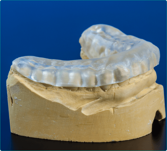 Model of jaw with clear nightguard over the teeth